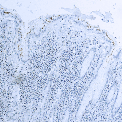 Formalin fixed paraffin embedded human infected tissue stained with H.pylori.