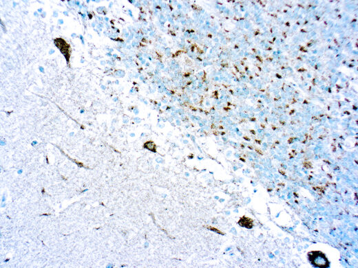 Formalin fixed paraffin embedded huma Cerebellum stained with Pan-TRK.