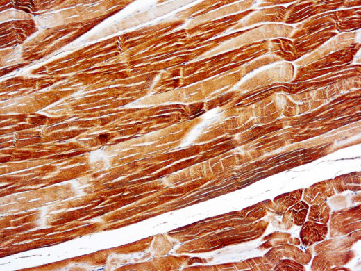 Formalin fixed paraffin embedded human skeletal muscle stained with Actin, Sarcomeric