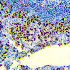 Formalin fixed paraffin embedded human tonsil stained with MUM1 protein antibody.