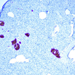 Formalin fixed paraffin embedded human Pancreas stained with NSE