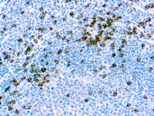 Formalin fixed paraffin embedded human tonsil stained with CD8