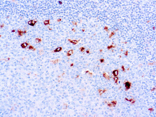 Formalin fixed paraffin embedded human tonsil stained with α-1-Antichymotrypsin
