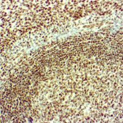 Formalin fixed paraffin embedded human pancreas stained with ATRX