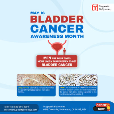 Bladder Cancer Awareness Social DBS
