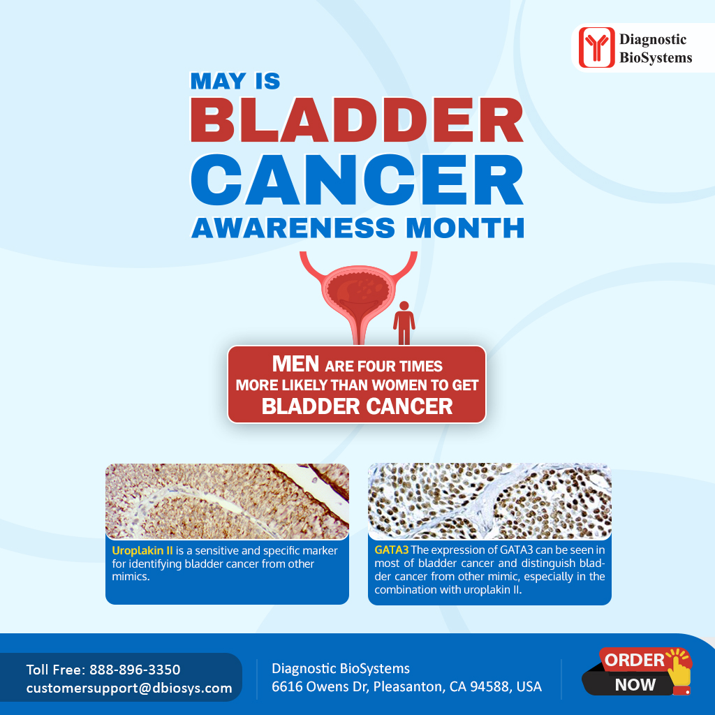 Bladder Cancer Awareness Month - Diagnostic BioSystems -Advanced Tissue ...