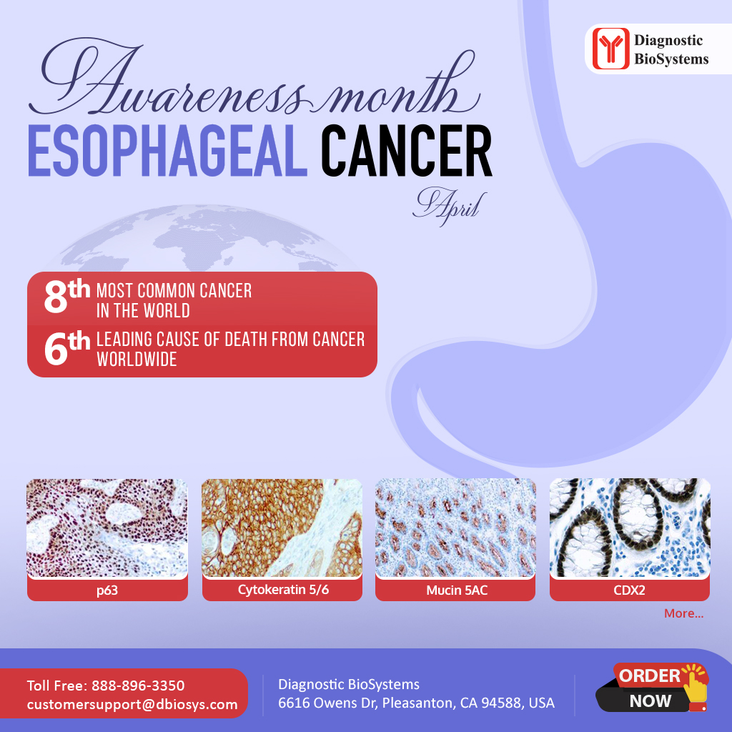 Esophageal Cancers Awareness Month - Diagnostic BioSystems -Advanced ...