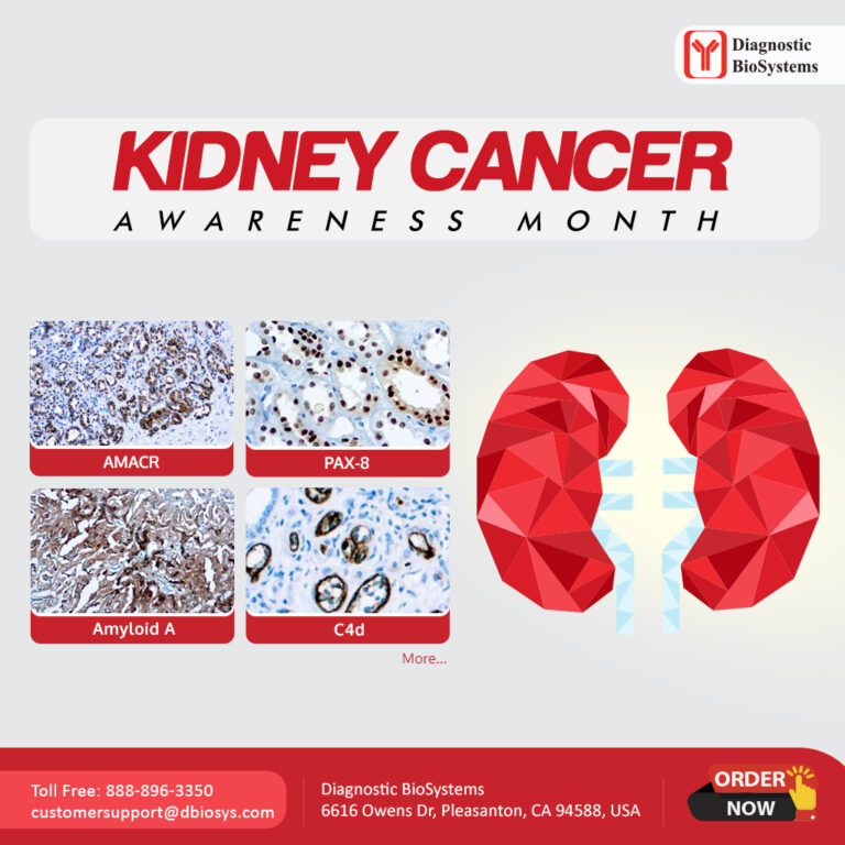 Kidney Cancer Awareness Month - Global IHC Company | Diagnostic ...
