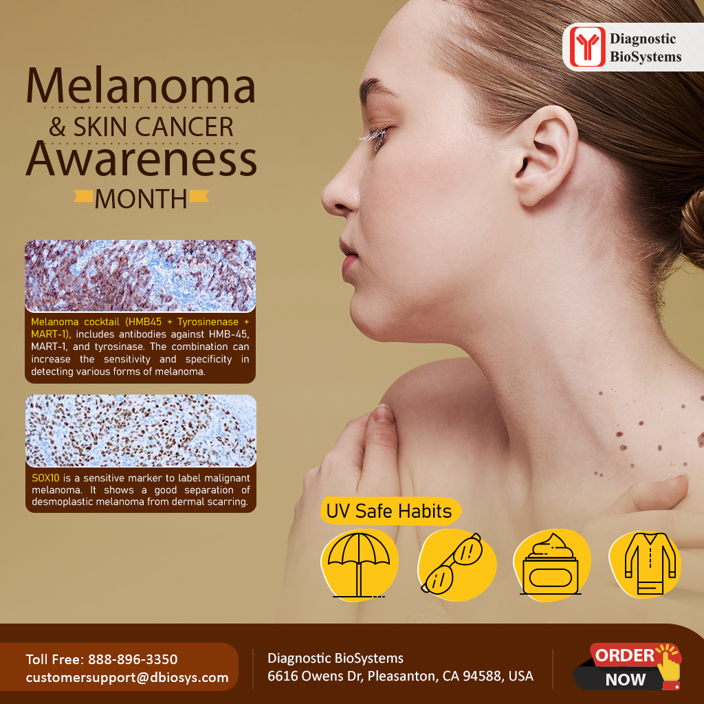 Melanoma Skin Cancer Awareness - Diagnostic BioSystems -Advanced Tissue ...