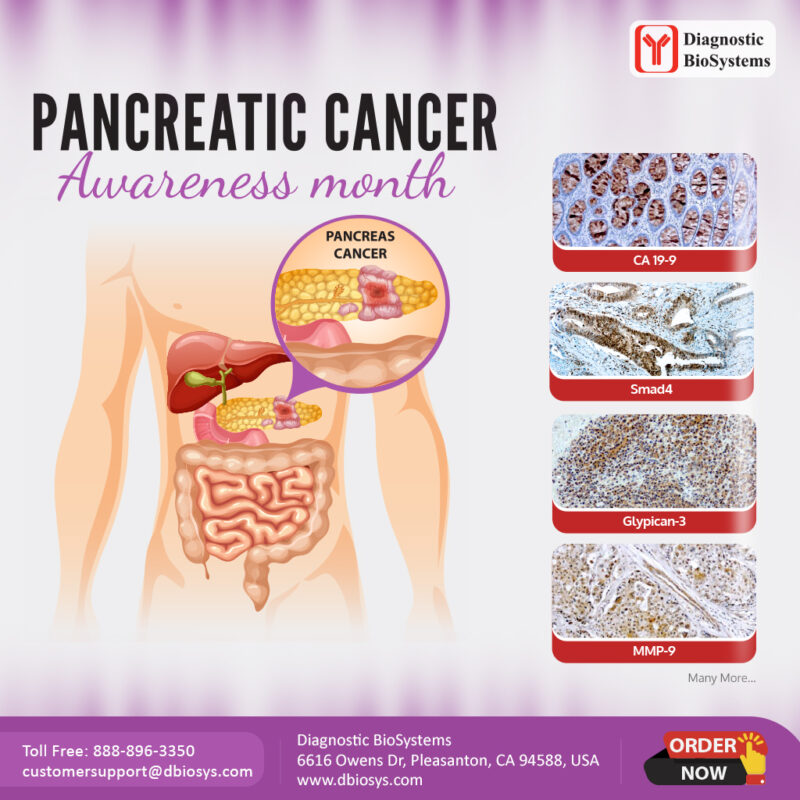 Diagnostic BioSystems Pancreatic Cancer Awareness 2022