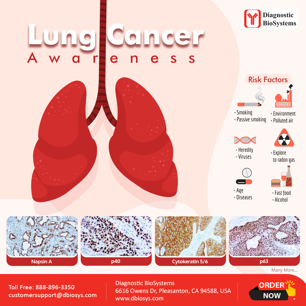 Lung Cancer Awareness! - Diagnostic BioSystems -Advanced Tissue ...