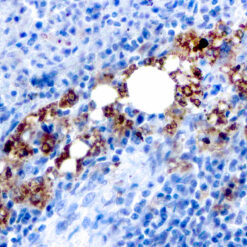 Formalin fixed paraffin embedded human Spleen stained with TRAcp