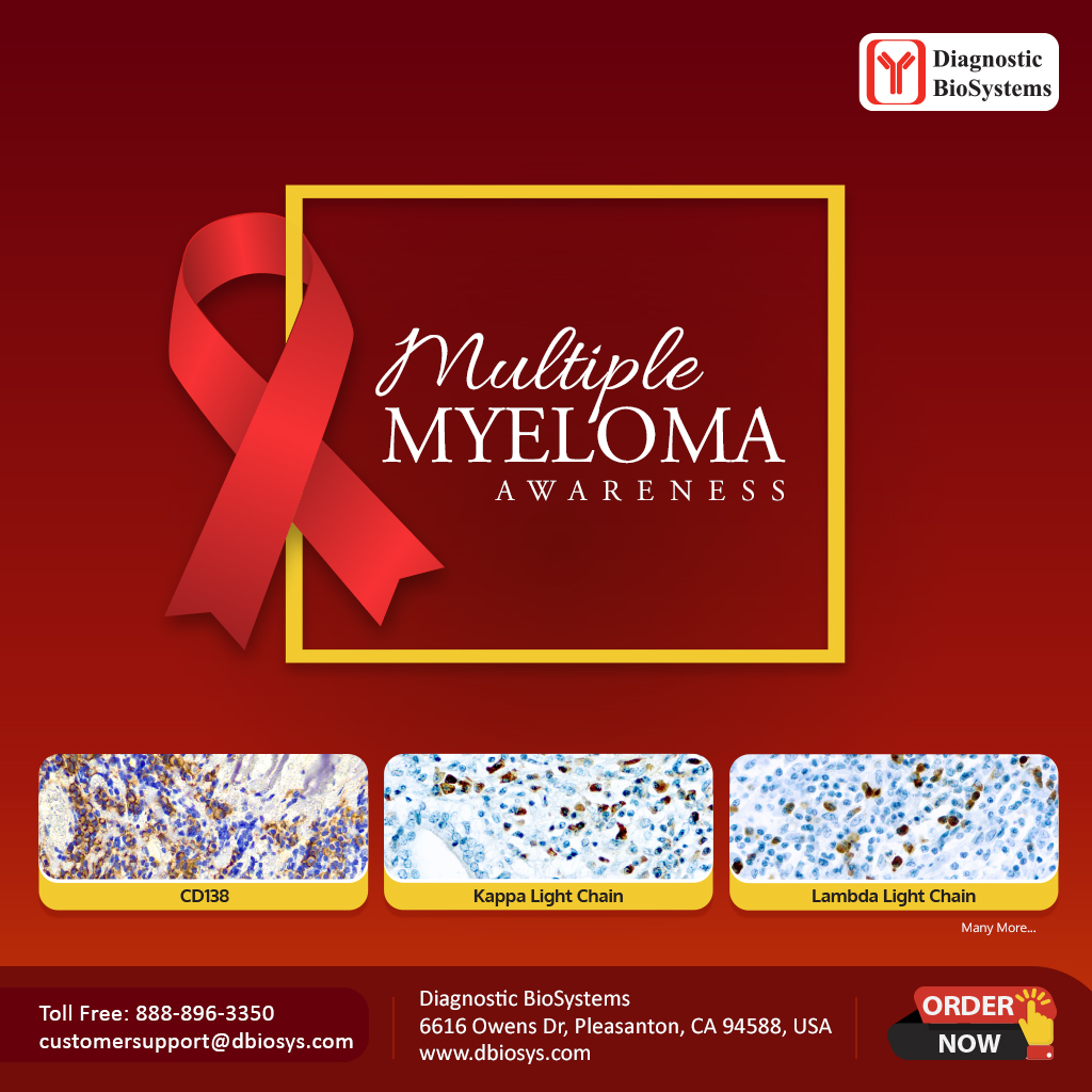 Myeloma Awareness Diagnostic BioSystems Advanced Tissue Diagnostics