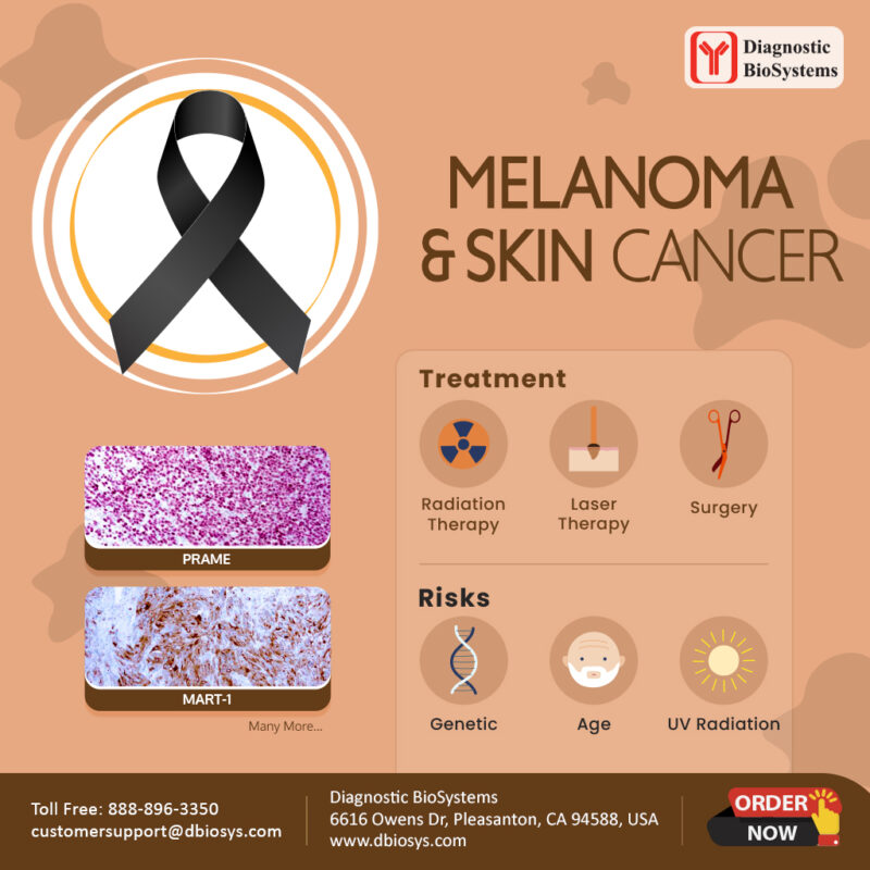 Melanoma Skin Cancer DBS 2023