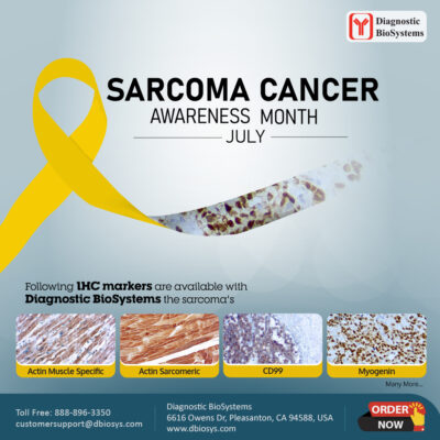 Sarcoma Cancer Awareness