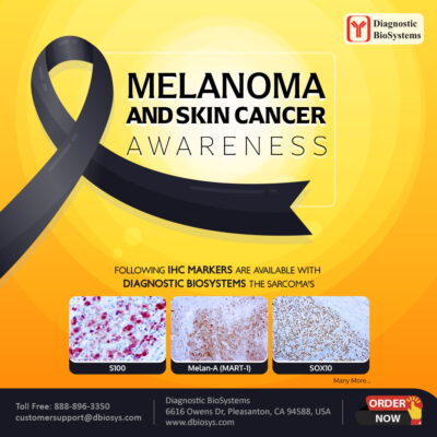 Melanoma Skin Cancer DBS 2024