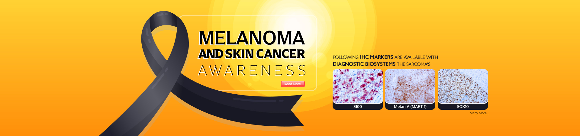 Melanoma and Skin Cancer Awareness 2024