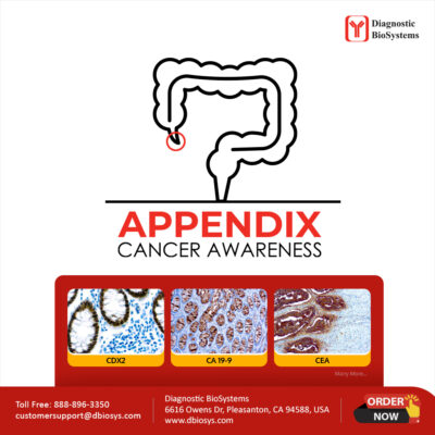 Appendix Cancer Awareness 2024