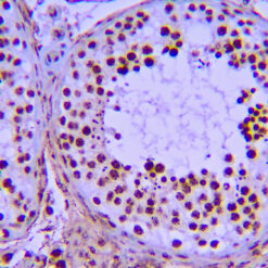 Formalin fixed paraffin embedded human testicular tissue stained with NUT1