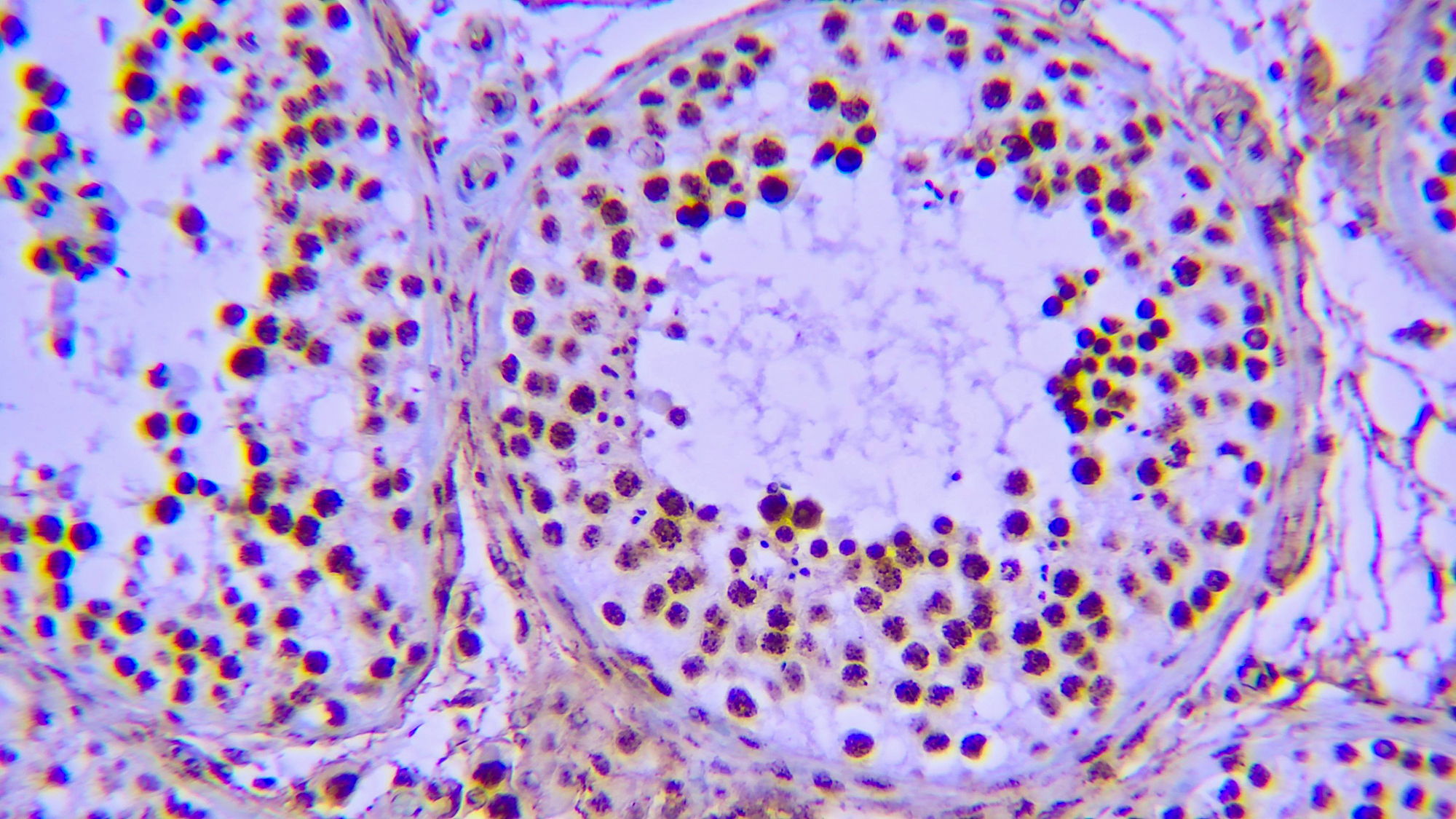 NUT1 1 Formalin fixed paraffin embedded human testicular tissue stained with NUT1