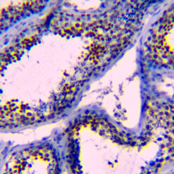 Formalin fixed paraffin embedded human testicular tissue stained with NUT1