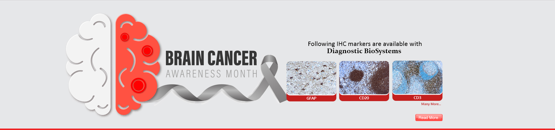 Brain cancer awareness 2026