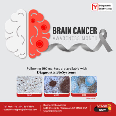 Diagnostic BioSystems Brain Cancer Awareness 2026